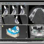 برنامج coDiagnostiX لتخطيط الزراعة الرقمية بدقة عالية