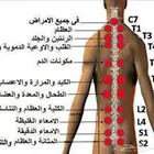 الحجامة النبوية