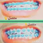 تقويم اسنان مده العرص اسبوع