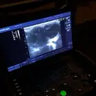 كشف اللقاح بالسونار لجميع الحيوانات