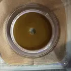 اكياس مفاغره قولون