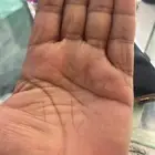 كاميرات تركيب الكاميرا الأمامية