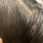 شامبوا للتخلص من القمل وبيضاته بظرف أيام فقط