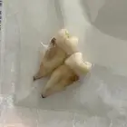 للبيع سن ضاحك