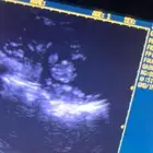 فحص سونار للحلال