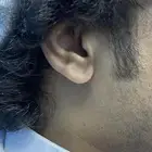 للبيع شحمة اذن على الشرط ماتشكي من شي المالك الاول