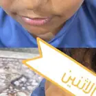 كريم تبييض
