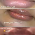 تفتيح الشفايف من جلسه وحده