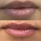 توريد وتصحيح لون شفايف