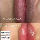 جلسة تفتيح وتوريد الشفايف وب الوان عض ويه طبيعيه
