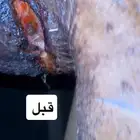 علاج جميع الجروح للخيل بدون خياطه ولا عمليه