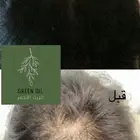 زيت لشعر صحي طبيعي