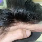 تركيب شبكيات شعر طبيعي بجوده عاليه