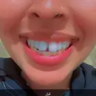 تقويم شفاف