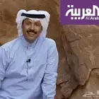 حجامة نبوية