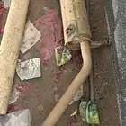 دبه شكمان ددسن