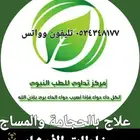 حجامة منزلية 125 ريال خبرة اكثر من 18 عام في مجال الحجامة