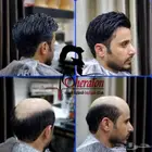 باروكات شعر طبيعي رجالي استرالي درجه اولى