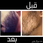 ىزيت ينبت ويكثف الشعر