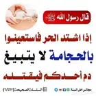الحجامة في الصيف