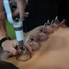 متخصص حجامة. رقية
