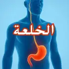 مسببات الخلعة