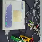 جهاز تخطيط القلب ECG