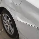 شفط بدون بوية