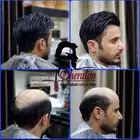 باروكات استرالي شبكيه درجه اولى