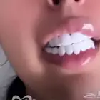ابتسامة هوليود