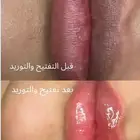 جلسة تفتيح وتوريد الشفايف ب الوان ع ضويه طبيعيه