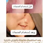 العناية المكثفه للبشرة