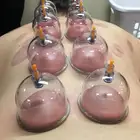 متخصص حجامة