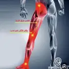 علاج عرق نساء