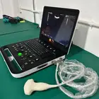 فحص الحمل للاغنام بالسونار