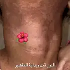 كريم بديل ابر التبيض