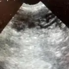 جهاز سونار