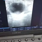 فحص سونار