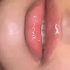 توريد الشفايف بتقنية المايكرو ونتائج تنافس العيادات