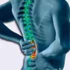 اخصائي علاج طبيعي