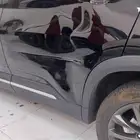 مركز بي6 شفط وتعديل جميع انواع الصدمات