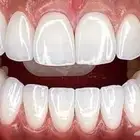 ابتسامة السعر 2000