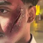 فن الجروح ورسم وجه