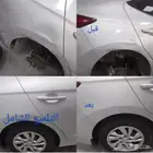 شفط وتعديل الصدمات على البارد