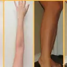 تركيبات طبعية صيدلانيه خاليه من الكرتزون بنسبة 95