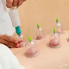 عمل حجامه نبوية
