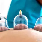 حجامة منزليه وعلاج طبيعي
