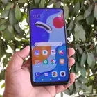 شاومي ريدمي نوت 11 اس