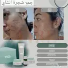 مجموعة علاج حب الشباب والحبوب الهرمونية.. طبية تركية