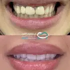 عروض ابتسامة هوليوود بمناسبة اليوم الوطني